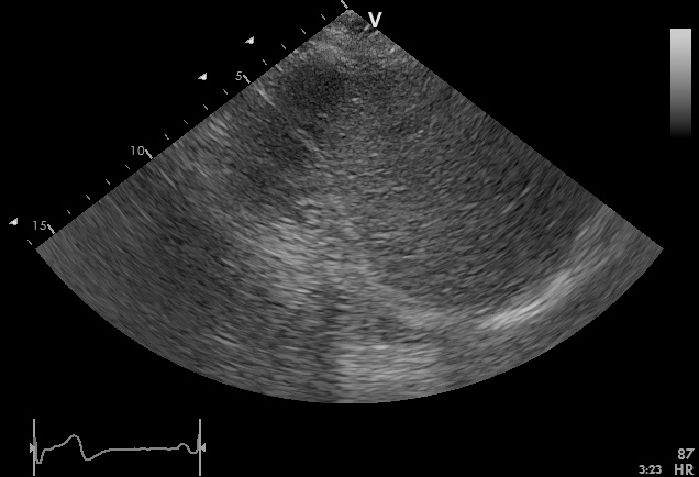 Sample Ultrasound Scan